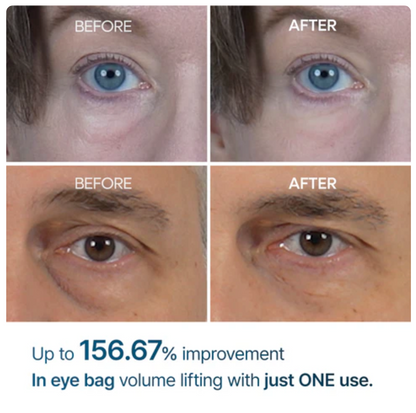 Dr. Melaxin Eyephalt Eye Bag Cream