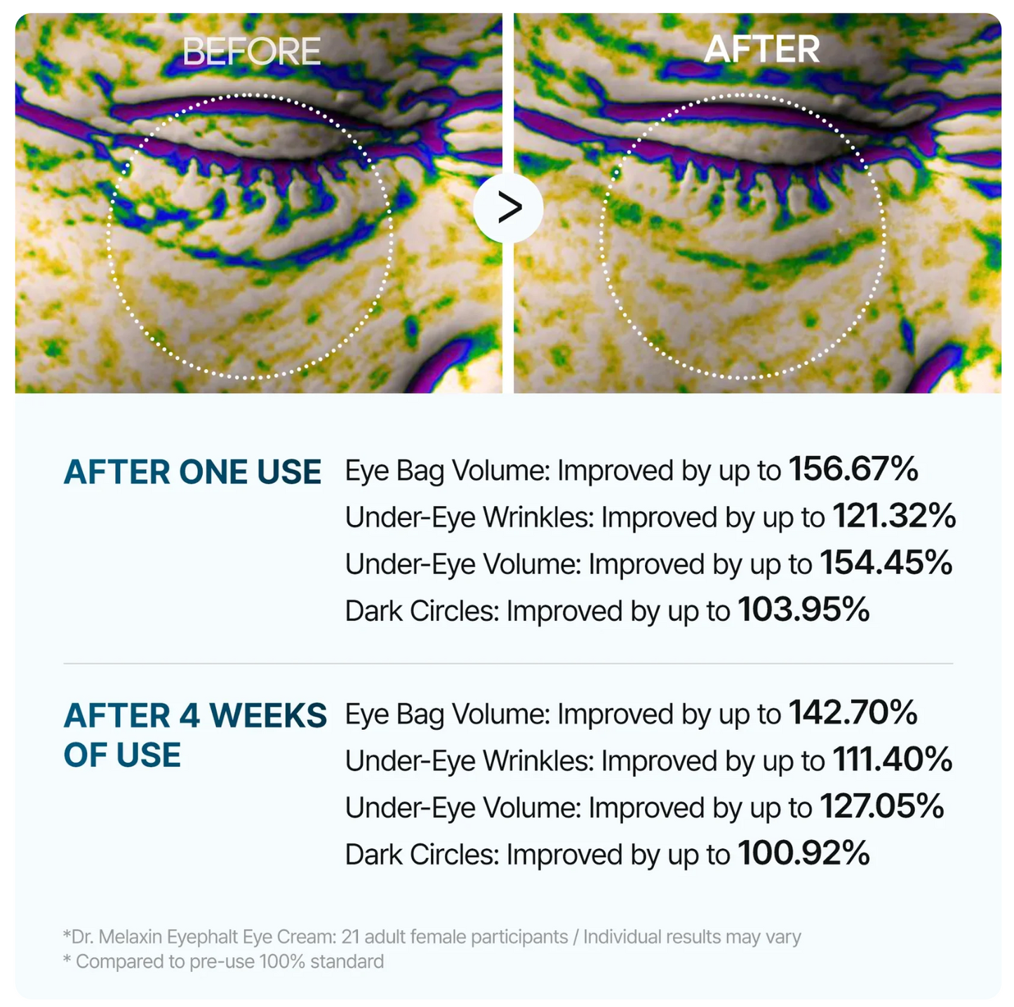 Dr. Melaxin Eyephalt Eye Bag Cream