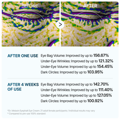 Dr. Melaxin Eyephalt Eye Bag Cream